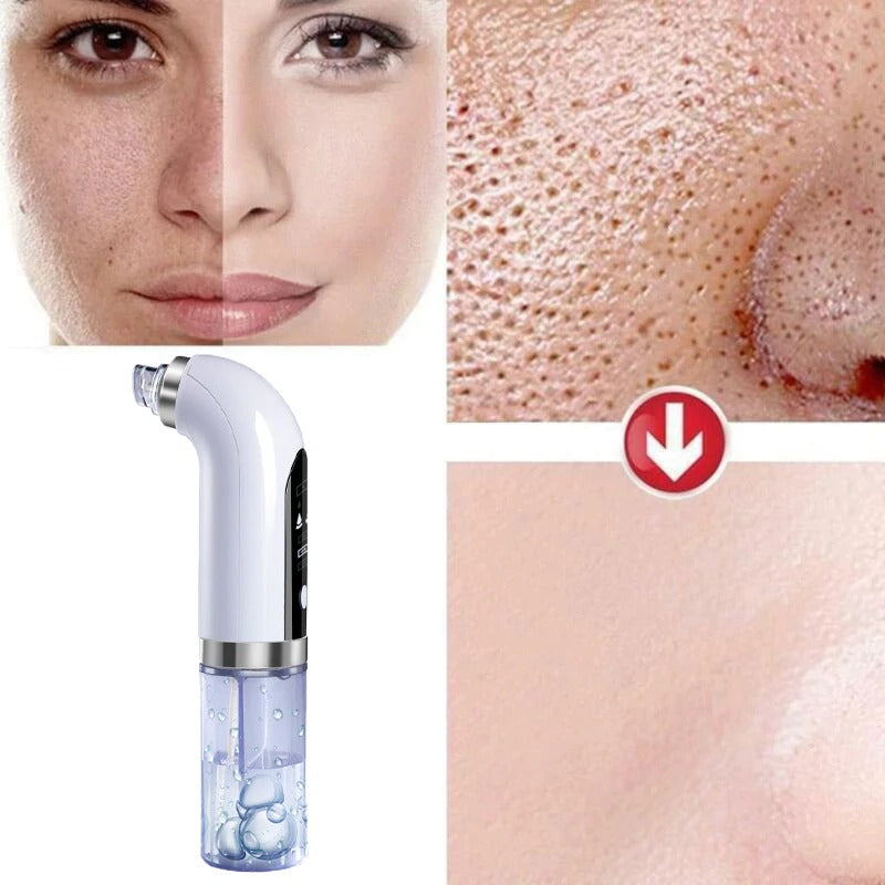 PurePore™ Multifunctionele Pore Cleaner